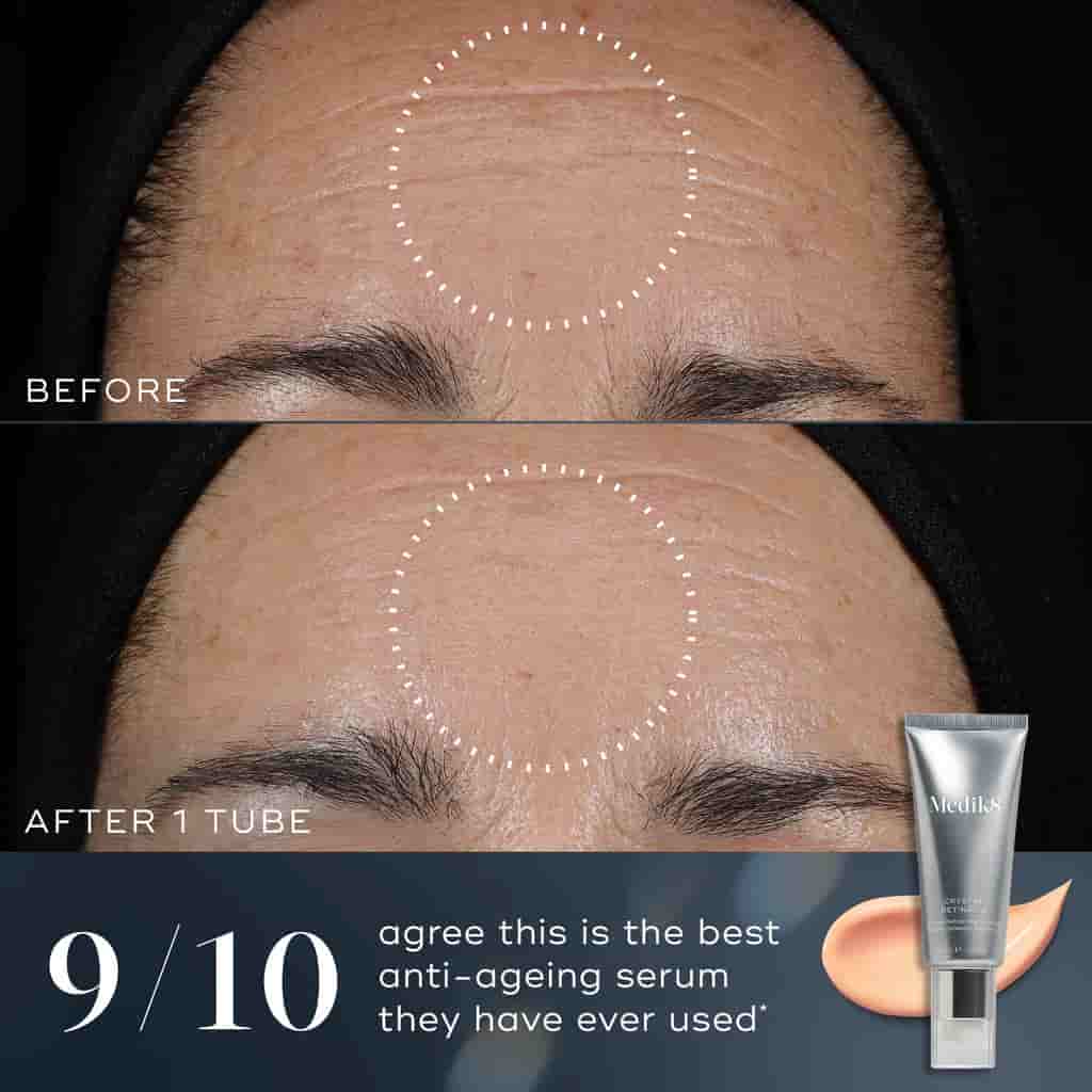 Before and after comparison of a face with, showing the effect of an anti-aging serum. A tube of the serum is also displayed.