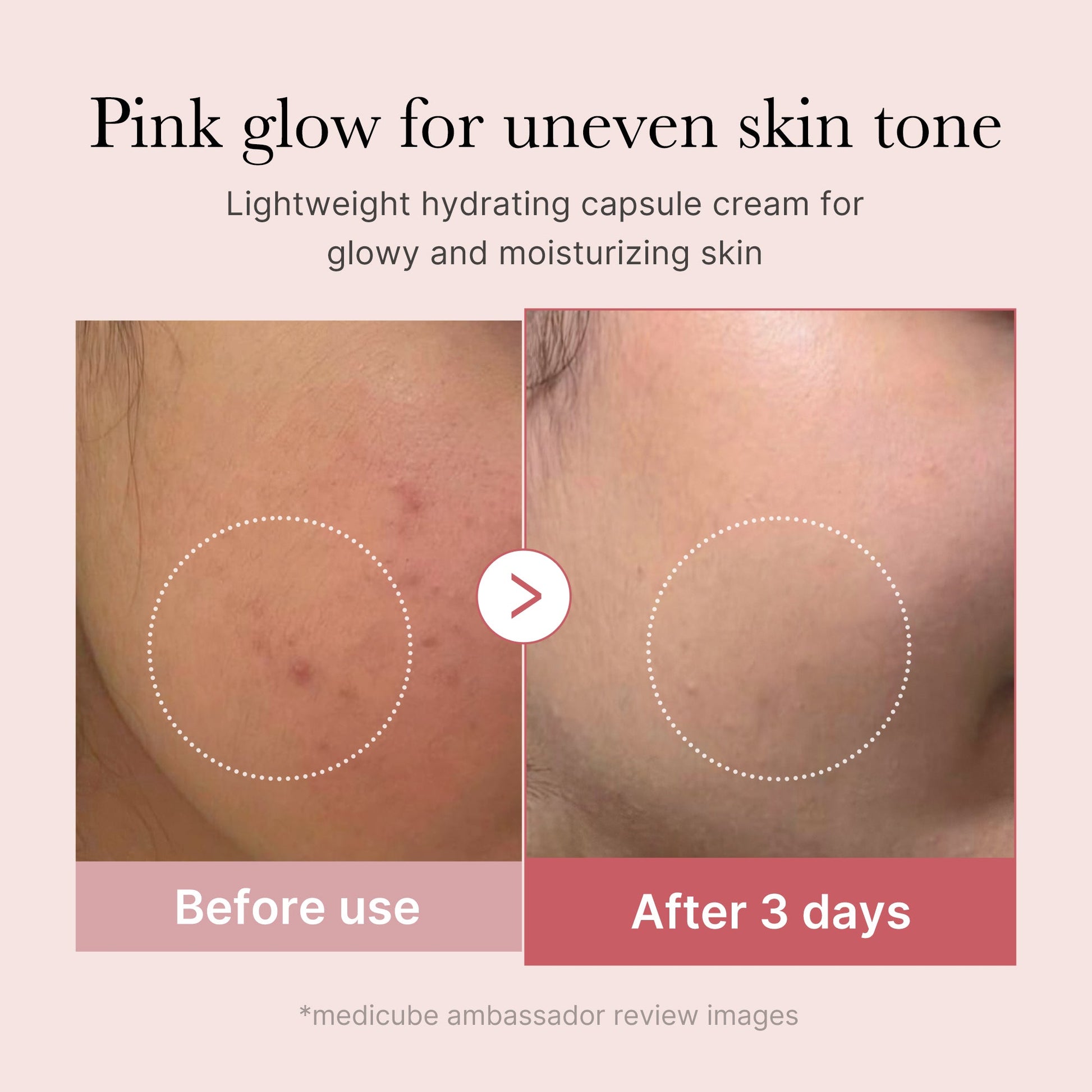Medicube PDRN Pink Collagen Capsule Cream - results